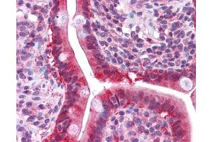 LGALS3 antibody was used for immunohistochemistry at a concentration of 4-8 ug/ml. (Galectin 3 Antikörper  (N-Term))