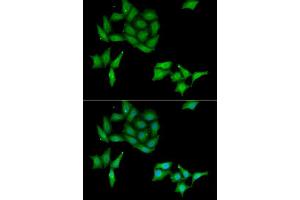 Immunofluorescence analysis of HeLa cells using CCNC antibody. (Cyclin C Antikörper  (AA 1-283))