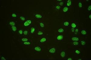 IF analysis of HAUSP/USP7 using anti-HAUSP/USP7 antibody (ABIN6719603). (USP7 Antikörper  (AA 258-483))