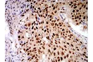 Immunohistochemistry (IHC) image for anti-Lectin, Galactoside-Binding, Soluble, 1 (LGALS1) (AA 1-135) antibody (ABIN5542520)