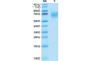 SDS-PAGE (SDS) image for Poliovirus Receptor (PVR) (AA 29-348) protein (His tag) (ABIN7274094)