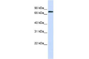 WB Suggested Anti-ZNF714 Antibody Titration:  0. (ZNF714 Antikörper  (N-Term))