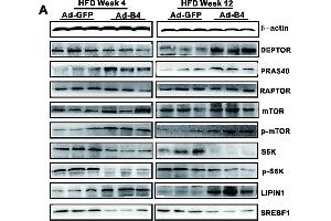 Western Blotting (WB) image for anti-Mechanistic Target of Rapamycin (serine/threonine Kinase) (mTOR) (C-Term) antibody (ABIN2855088)