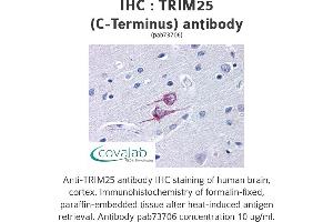 Image no. 1 for anti-Tripartite Motif Containing 25 (TRIM25) antibody (ABIN1740361) (TRIM25 Antikörper)