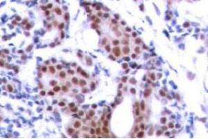 Image no. 2 for anti-ELK1, Member of ETS Oncogene Family (ELK1) (pSer383) antibody (ABIN318012) (ELK1 Antikörper  (pSer383))