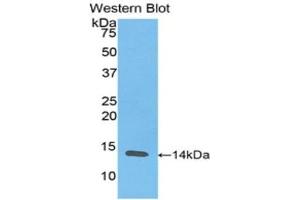 Western Blotting (WB) image for anti-Resistin (RETN) (AA 17-108) antibody (ABIN3201518) (Resistin Antikörper  (AA 17-108))