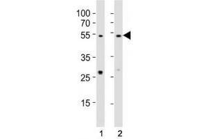 Western blot testing of EED antibody at 1:1000 dilution. (EED Antikörper  (AA 269-303))