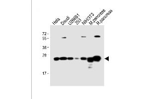 All lanes : Anti-RPL10 Antibody (N-term) at 1:4000 dilution Lane 1: Hela whole cell lysate Lane 2: Daudi whole cell lysate Lane 3: U266B1 whole cell lysate Lane 4: 293 whole cell lysate Lane 5: NIH/3T3 whole cell lysate Lane 6: Mouse pancreas lysate Lane 7: Rat pancreas lysate Lysates/proteins at 20 μg per lane. (RPL10 Antikörper  (N-Term))