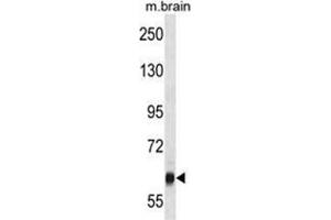 VPS45 Antibody (C-term) western blot analysis in mouse brain tissue lysates (35 µg/lane). (VPS45 Antikörper  (C-Term))