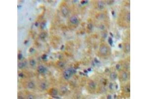 Used in DAB staining on fromalin fixed paraffin-embedded Liver tissue (APOE Antikörper  (AA 19-181))