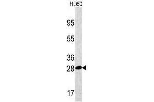 Image no. 2 for anti-Proteasome Subunit alpha 5 (PSMA5) (Middle Region) antibody (ABIN356946) (PSMA5 Antikörper  (Middle Region))