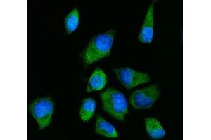 IF analysis of RPS2 using anti-RPS2 antibody (ABIN7601997). (RPS2 Antikörper  (AA 54-293))