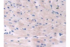 Detection of ADCY6 in Mouse Heart Tissue using Polyclonal Antibody to Adenylate Cyclase 6 (ADCY6)