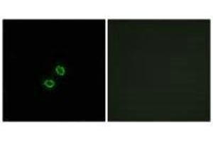 Immunofluorescence analysis of A549 cells, using KIR2DL5B antibody. (KIR2DL5B Antikörper)