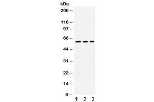 Western blot testing of human 1) A549, 2) 22RV1 and 3) U20S cell lysate with RAG2 antibody. (RAG2 Antikörper)