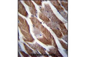 TN1 Antibody (C-term) (ABIN656749 and ABIN2845972) immunohistochemistry analysis in forlin fixed and paraffin embedded hun skeletal muscle followed by peroxidase conjugation of the secondary antibody and DAB staining. (MATN1 Antikörper  (C-Term))