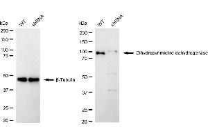 Western blotting analysis using Dihydropyrimidine dehydrogenase antibody (ABIN7798341).