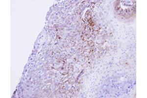 Immunohistochemistry (IHC) image for anti-Calcium Channel, Voltage-Dependent, L Type, alpha 1S Subunit (CACNA1S) (Center) antibody (ABIN2855522)