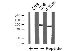 Western blot analysis of extracts from Jurkat/293 cells, using TOP1 antibody. (Topoisomerase I Antikörper  (Internal Region))