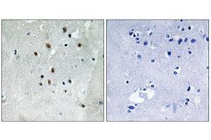 Immunohistochemistry (IHC) image for anti-Serum Response Factor (SRF) (pSer77) antibody (ABIN1847570) (SRF Antikörper  (pSer77))
