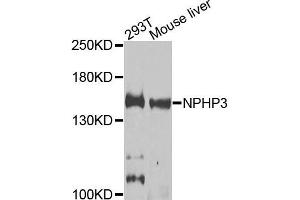 Western blot analysis of extracts of 293T and mouse liver cells, using NPHP3 antibody. (NPHP3 Antikörper)