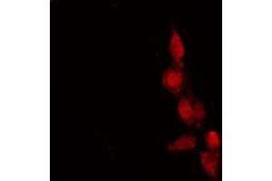 ABIN6278619 staining HeLa by IF/ICC. (OR9G1 Antikörper  (Internal Region))