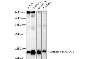 Western blot analysis of extracts of various cell lines, using Osteocalcin (BGLAP) antibody (ABIN7269118) at 1:1000 dilution. (Osteocalcin Antikörper)
