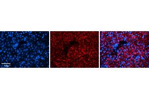 Rabbit Anti-DPH1 Antibody Catalog Number: ARP51955_P050 Formalin Fixed Paraffin Embedded Tissue: Human Liver Tissue Observed Staining: Cytoplasm in hepatocytes Primary Antibody Concentration: 1:100 Other Working Concentrations: 1:600 Secondary Antibody: Donkey anti-Rabbit-Cy3 Secondary Antibody Concentration: 1:200 Magnification: 20X Exposure Time: 0.