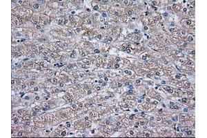 Immunohistochemical staining of paraffin-embedded Human liver tissue using anti-TBXAS1 mouse monoclonal antibody. (TBXAS1 Antikörper)