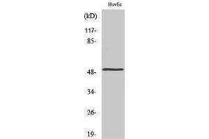 Western Blotting (WB) image for anti-MAP Kinase Interacting serine/threonine Kinase 1 (MKNK1) (Internal Region) antibody (ABIN6285115)