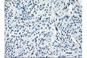 Immunohistochemical staining of paraffin-embedded Ovary tissue using anti-TMEM100mouse monoclonal antibody. (TMEM100 Antikörper)