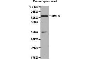 Western Blotting (WB) image for anti-Matrix Metallopeptidase 9 (Gelatinase B, 92kDa Gelatinase, 92kDa Type IV Collagenase) (MMP9) antibody (ABIN1873732) (MMP 9 Antikörper)