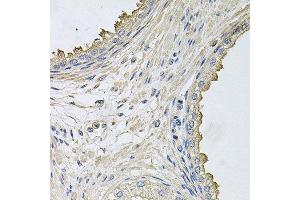 Immunohistochemistry of paraffin-embedded human prostate using HERC3 antibody at dilution of 1:100 (x40 lens). (HERC3 Antikörper)