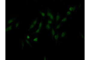 Immunofluorescence staining of Hela Cells with ABIN7127650 at 1:50, counter-stained with DAPI. (Rekombinanter NUP98 Antikörper)