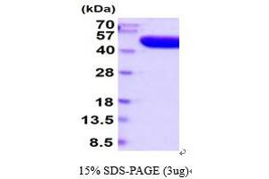 SDS-PAGE (SDS) image for Acid Phosphatase, Prostate (ACPP) (AA 33-386) (Active) protein (His tag) (ABIN7281138) (ACPP Protein (AA 33-386) (His tag))