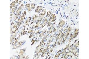 Immunohistochemistry of paraffin-embedded Mouse stomach using TIMM10B Polyclonal Antibody at dilution of 1:100 (40x lens). (TIMM10B Antikörper)