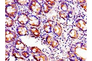 Immunohistochemistry of paraffin-embedded human small intestine tissue using ABIN7149308 at dilution of 1:100 (Aconitase 1 Antikörper  (AA 508-745))