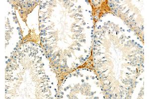 ABIN6263378 and ABIN6279009 at 1/100 staining Rat testis tissue by IHC-P. (MRPS15 Antikörper  (Internal Region))