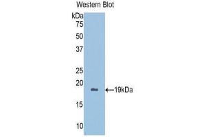 Western Blotting (WB) image for anti-Peroxiredoxin 5 (PRDX5) (AA 1-162) antibody (ABIN1078432) (Peroxiredoxin 5 Antikörper  (AA 1-162))