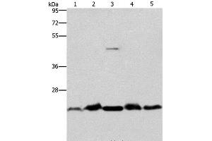 Western Blot analysis of Mouse spleen and Human fetal liver tissue, hela cell and Mouse testis tissue, A431 cell using THOC7 Polyclonal Antibody at dilution of 1:500 (THOC7 Antikörper)