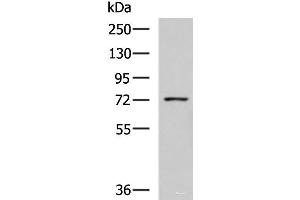 Western blot analysis of K562 cell lysate using GUSB Polyclonal Antibody at dilution of 1:800 (Glucuronidase beta Antikörper)