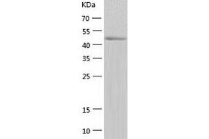 Western Blotting (WB) image for Tyrosyl-tRNA Synthetase 2, Mitochondrial (YARS2) (AA 17-477) protein (His tag) (ABIN7289483) (YARS2 Protein (AA 17-477) (His tag))