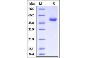 Biotinylated Human CTLA-4, Fc tag on SDS-PAGE under reducing (R) condition.