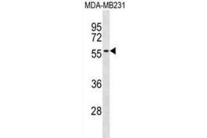 Western Blotting (WB) image for anti-A Kinase (PRKA) Anchor Protein 5 (AKAP5) antibody (ABIN3000745) (AKAP5 Antikörper)