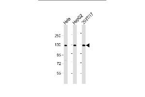 All lanes : Anti-LRIG3 Antibody (N-Term) at 1:2000 dilution Lane 1: Hela whole cell lysate Lane 2: HepG2 whole cell lysate Lane 3: 293T/17 whole cell lysate Lysates/proteins at 20 μg per lane. (LRIG3 Antikörper  (AA 23-54))