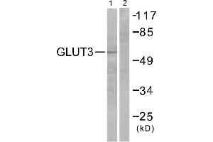 Western blot analysis of extracts from LOVO cells, using GLUT3 antibody (#C0214). (SLC2A3 Antikörper)