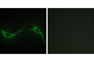 Peptide - +Immunohistochemistry analysis of paraffin-embedded human brain tissue using ADCY7 antibody. (ADCY7 Antikörper)