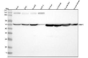 Western blot analysis of SFRP4 using anti-SFRP4 antibody (ABIN7606286).
