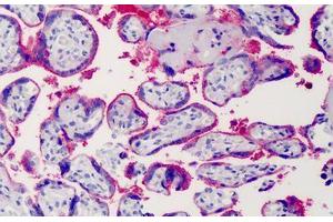 Human Placenta: Formalin-Fixed, Paraffin-Embedded (FFPE) (Syndecan 1 Antikörper)