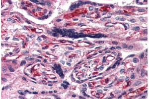 Immunohistochemistry (IHC) image for anti-Adenylate Cyclase Activating Polypeptide 1 (Pituitary) Receptor Type I (ADCYAP1R1) (N-Term) antibody (ABIN1048297)